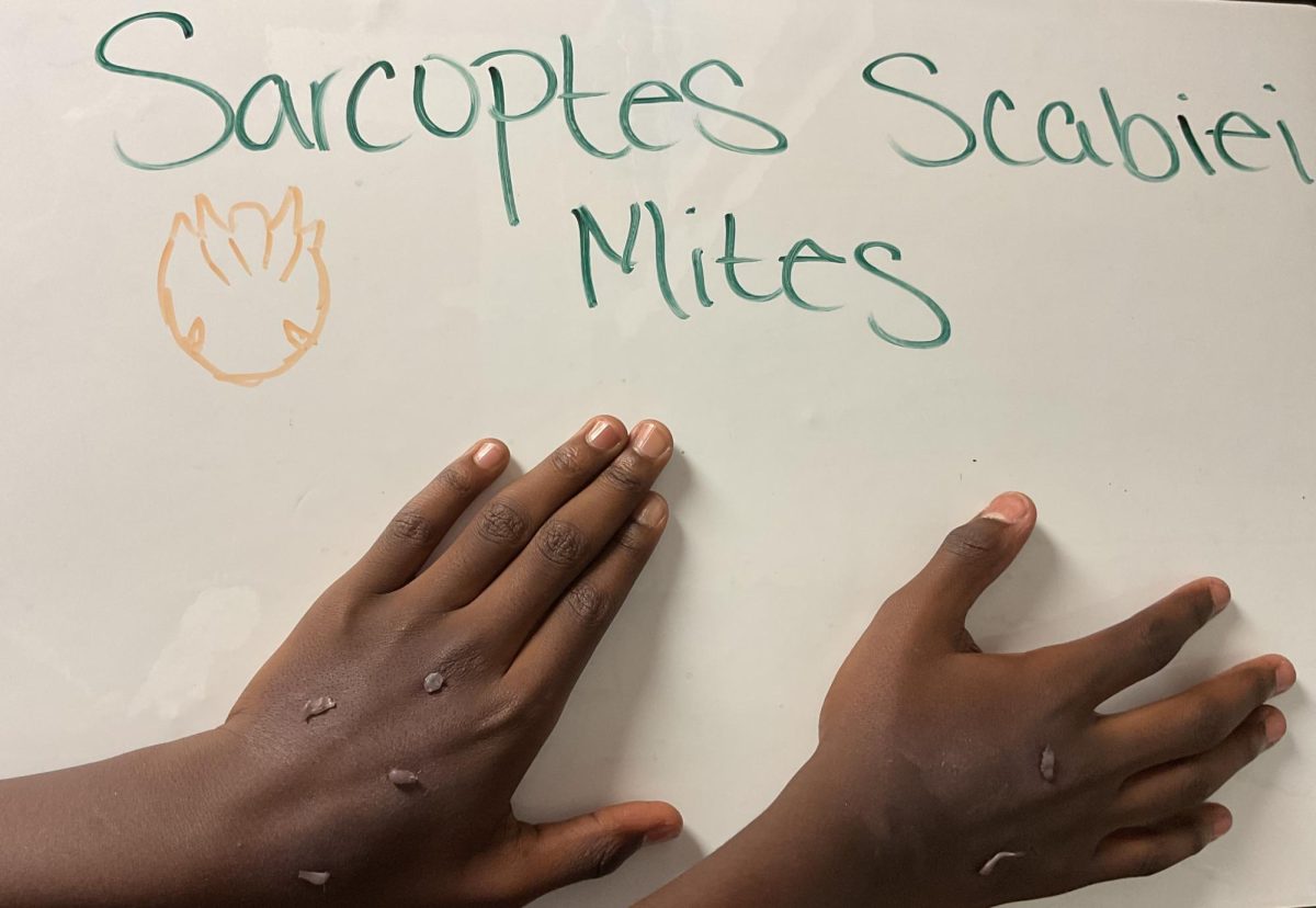 The rise of Scabies